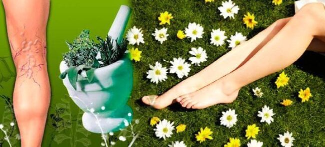 Home remedies for varicose veins in the legs, which contribute to a speedy recovery. 