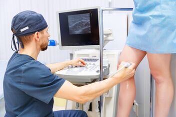 diagnosis of varicose veins